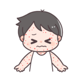 【医療・衛生】湿疹のかわいいフリーイラスト